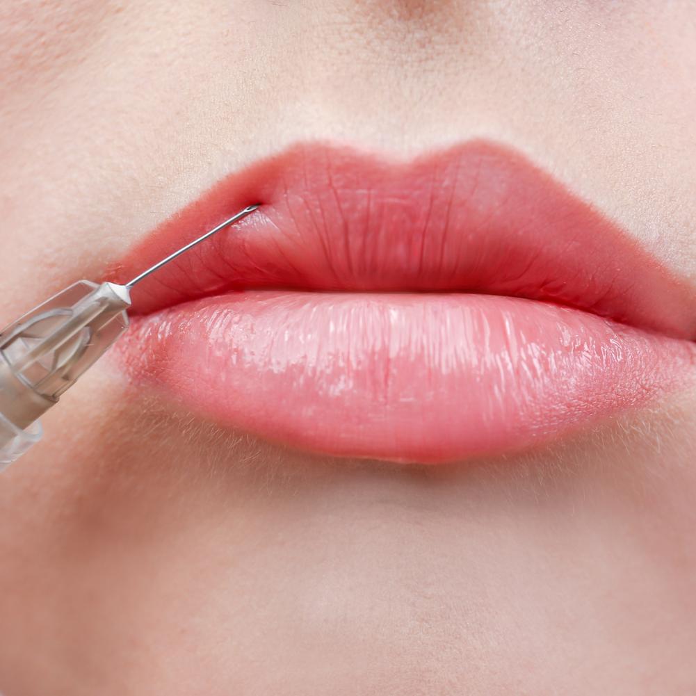 Herpes − So wirst Du ihn los