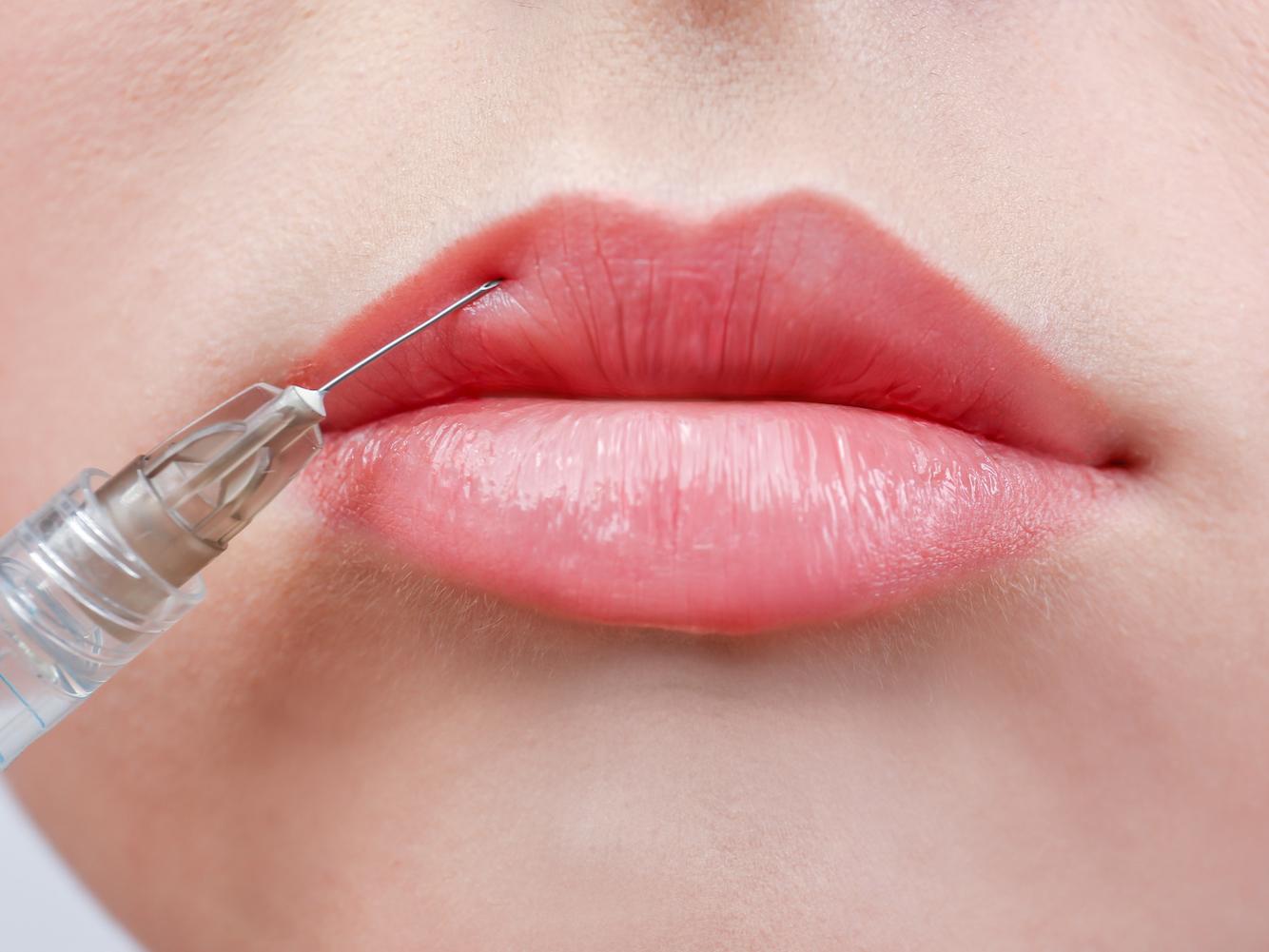 Herpes − So wirst Du ihn los